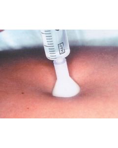 S.I.T. TERAPIA INIEZIONE CUTANEA 31G 0,26x2,5mm - bianco conf. 25 pezzi