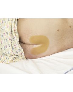 TEGADERM 3M IDROCOLLOID Medicazione sterile idrocolloidale 16x17 cm conf. 6 pezzi