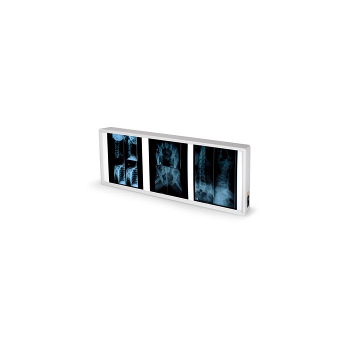 Negativoscopio doppio bianco freddo 6.500°K-38x92 cm