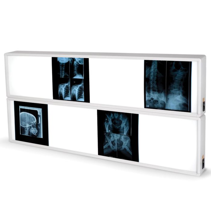 NEGATIVOSCOPIO 2x4 PANNELLI 76 x 153 cm 
