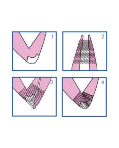Rete Tubolare Elastica Calibro 3 per Mano, Gomito e Braccio Surgifix Poly